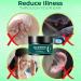 HEIMEABI 30g Tinnitus Ear Care Remover - Soothing & Relieving Green One Size - Buy Online on SooperMarket.com