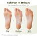PURDERM Shiny & Soft Foot Peeling Mask (6 Pack) - Exfoliating Treatment for Cracked, Dry, Callused Feet - Removes Dead Skin & Reveals Baby Soft, Smooth Skin - Lemon & Natural Botanical Extracts - Buy Online on SooperMarket.com