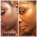 Aroma Depot Raw African Black Soap 1/2 Gallon - 100% Natural for Acne, Eczema, Psoriasis - Handmade from Ghana - Buy Online on SooperMarket.com