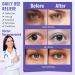 Serfeymi 16-Pack Self-Heating Steam Eye Masks for Sleeping - Lavender & Chamomile | Disposable Eye SPA Mask for Mother's Day Gifts - Buy Online on SooperMarket.com