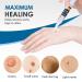 Extra Strength Skin Tag Remover | Wart Removal | Tag Dries and Falls Away | Natural Ingredients | All Skin Types - Buy Online on SooperMarket.com