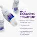 Head & Shoulders Scalp X 2% Minoxidil for Women - Hair Regrowth Treatment Thinning Hair & Hair Loss Solution 3 Month Supply (3 x 2 Fl Oz - Buy Online on SooperMarket.com