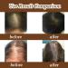 wimony Batana Oil Organic Batana Oil For Hair Growth 100% Pure Raw Natural Batana Oil for Healthy Hair Batana Oil Hair Treatment Promotes Hair Growth Smoother and Shinier Thicker Improve Hair Loss(1PC - Buy Online on SooperMarket.com