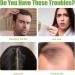 Rosemary Hair Oil(60ml) Rosemary Oil for Hair Growth Diluted Rosemary Essential Oils for Hair Loss & Skin Care Strengthens Hair Nourishes Scalp Hair Loss Improve Oil for Women and Men - Buy Online on SooperMarket.com
