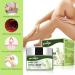 Purvigor Varicose Vein Cream - Eliminate Spider Veins & Phlebitis Angiitis on Leg, Body & Arms - Buy Online on SooperMarket.com