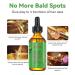 Rosemary Hair Growth Oil & Serum - Dry Scalp Treatment for Women | Hair Thickening & Essential Oil (2OZ) - Boost Hair Growth & Combat Hair Loss - Buy Online on SooperMarket.com