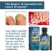 Fungal Nail Treatment - Extra Strong Nail Fungus Treatment for Toenail and Fingernail - Fungal Nail Eliminator Anti fungus Nail Repair and Strengthen Fix & Renew Damaged Broken Nails 30ml - Buy Online on SooperMarket.com