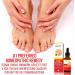 Natural Nail & Toenail Repair Treatment - Extra Strength Drops for Nails, Athlete's Feet, Jock Itch, Ringworm & Skin Rash - USA Made - Buy Online on SooperMarket.com