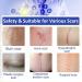 Silicone Scar Sheet Tape - Softens & Flattens Surgery, Injury, Burn, C-Section Scars - Safe & Painless Scar Removal - 1.6 x 120 Inch - Buy Online on SooperMarket.com