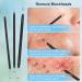 Fangze Pimple Popper Tool Kit - 10pcs Stainless Steel Blackhead Remover Set with Leather Bag - Buy Online on SooperMarket.com