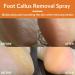 Tongyend Foot Peeling Spray Foot Callus Removal Spray Foot Peel Spray Instant Foot Peeling Spray Orange Oil Soften& Moisturize Peel-Off Spray for Cracked Rough Dry Skin Foot Care - Buy Online on SooperMarket.com