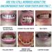 Premium Teeth Whitening Gel - 3 Pack Stain Removal & Breath Freshening - Protect & Brighten Your Smile - Buy Online on SooperMarket.com
