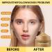 Turmeric & Vitamin C Clay Face Mask for Dark Spots | Blackhead Remover & Deep Cleansing Facial Mask 4.2OZ - Buy Online on SooperMarket.com