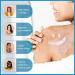 MIELIKKI Vitiligo Cream | Reduce White Spots & Enhance Skin Pigmentation | Natural Vitiligo Care Cream for All Skin Types - Buy Online on SooperMarket.com