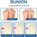 Orthoes Bunion Relief Socks - Projoint Antibunions Health Compression Socks (5 Pairs) - Buy Online on SooperMarket.com