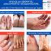 TIS CREME with 15% Urea - Eczema Psoriasis Dry Skin Relief | Wound Healing for Hands Feet Knees & Nails | 50 ml Pack - Buy Online on SooperMarket.com