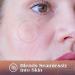 AUSLKA Pimple Patches (174 Patches) - Hydrocolloid Patches - Invisible Pimple Spot Stickers - Facial Stickers All Skin Types - Buy Online on SooperMarket.com