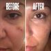Dark Spot Corrector Serum - Remove Stubborn Dark Spots with Kojic Acid & Alpha Arbutin | Brightening Discoloration Remover for Face - Buy Online on SooperMarket.com