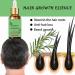 Trendyfave Rosemary Oil For Hair Growth Nourishes Hair Care Essential Oil Anti Frizz Hair Serum Ginger Hair Oil for Dry Damaged Hair | Repairs Smoothens Revitalizes Your Hair - for All Hair Types - Buy Online on SooperMarket.com