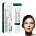 Facial Black Spot Remover Cream Facial Correction Cream Nicotinamide Facial Essence Skin Repair for Lightening Sunburn and Acne Marks Lightening Pigmentation and Rapidly Improving Skin Color 50 ml