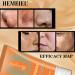 Calendula Peel Off Facial Mask - Blackhead & Pore Minimizer | Deep Cleansing Gold Mask for All Skin Types - Buy Online on SooperMarket.com