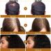 Go Ho Batana Oil for Hair Growth(50ml) Hair Growth Serum Hair Growth Oil with Castor Oil Coconut Oil for Women and Men Moisturizing & Strengthening Serum for Scalp & Hair Care - Buy Online on SooperMarket.com