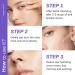 Niacinamide Serum With Fruit Acid Korean Serum Reduces Redness Hydrating Serum Improve Blemishes Dark Spot Correcting Glow Serum Brightening Serum For All Skin Type Serums Skincare - Buy Online on SooperMarket.com