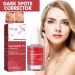 Tongyend Dark Spot Serum Brightening Serum Niacinamide Serum Faded Cream For Dark Spots Dark Spot Corrector For Face Age Spot Remover For Face Face Redness Remover Arbutin Serum Acne Scar 30ml - Buy Online on SooperMarket.com