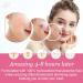156 PCS Star-Shaped Pimple Patch Set - Hydrocolloid with Tea Tree Oil & Salicylic Acid - Waterproof Suitable for All Skin Types - Pink & Green - Buy Online on SooperMarket.com