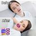 Mouth Tape For Sleeping Quit Mouth Breathing Device Anti Snoring Promotes Nasal Breathing Adhesive Non Woven Fabric Cute Pattern Large Size For Adults 30 Sheets For 30 Days Supply 30 Sheets Forming A New Habit Large Size for Adults - Buy Online on SooperMarket.com