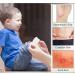 Self-Adhesive Silicone Scar Strips for Acne Scars - Moisturizing & Stretchy Grade A Scar Sheets for Effective Repair - Buy Online on SooperMarket.com