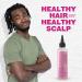 Immetee Scalp Hair Oil - Best Treatment for Dry Itchy Scalp | Anti-Itch Care for Natural & Curly Hair | 190ml (6.42fl oz - Buy Online on SooperMarket.com