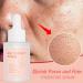 Multi Effect Hydrating Serum - Vitamin C Serum For Face Anti Aging Face Serum Niacinamide & Hyaluronic Acid Serum Evens Skin Tone And Hydrating Dark Spot Corrector Pore Remover - Buy Online on SooperMarket.com