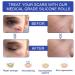 Breathable Scar Sheet Roll - 3 Meter Wide Tape for Scar Protection - Buy Online on SooperMarket.com