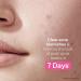 StriVectin Multi Action Clear Acne Treatment Set | 30-Day Trial Kit for Clearer Smoother Skin | Blemish Control & Breakout Defense - Buy Online on SooperMarket.com