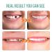 2 PCS Fake Teeth Veneers for Temporary Tooth Repair - Men and Women | Dental Veneers for Upper and Lower Jaw | Regain a Confident Smile with Bright White Results - Buy Online on SooperMarket.com
