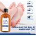 Urea 42% Foot Cream Foot Nourishing Cream For Cracked Heels And Dry Skin Deep Moisturizing Callus Remover For Dry And Hard Skin Feet And Hand Maximum Strength For Hand Foot And Body Care - Buy Online on SooperMarket.com