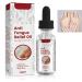 TBeautfave Fungal Nail Treatment Antifungal Nail Treatment Toe Nail Fungal Treatment Fungal Nail Treatment for Toenails Extra Strong Nail Repair and Strengthen Fix & Renew Damaged Broken Nails
