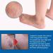 Varicose Vein Treatment Spray & Serum - 2 x 20ml for Spider Veins Relief | Effective Vein Care Cream - Buy Online on SooperMarket.com