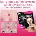 AGETITY Nose Strips 90 Pcs - Blackhead Remover for Women - Deep Cleansing Pore Strips - Buy Online on SooperMarket.com