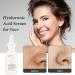 Hyaluronic Acid 2% + B5 30ML Hyaluronic Acid Serum for Face Dark Spot Remover for Face Hyaluronic Acid Face Moisturize Skincare Serum for Face to Plump and Smooth Skin for All Skin Types Skin Care - Buy Online on SooperMarket.com