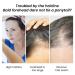 Hair Growth Oil | Jojoba & Wild Oil - Natural Anti-Frizz Density Boost for Men & Women - 30 ml | Aznever - Buy Online on SooperMarket.com