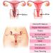 Anniecare Natural Repair Vaginal Capsule | Instant Anti-Itch & Tighten | 4PCS - Buy Online on SooperMarket.com
