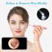 3.9mm Otoscope Ear Endoscope for Ear Wax Removal | 6-Light Ear Inspection Camera HD Waterproof Ear Scope for Kids and Adults | Pink | Compatible with Android iPhone - Buy Online on SooperMarket.com
