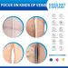 Varicose Veins Cream - Effective Treatment for Leg Relief, Phlebitis & Circulation Improvement (1.7 Fl Oz) - Buy Online on SooperMarket.com