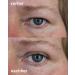 Magic Invisible Eyelid Lifting Tape for Girls - 240 Pieces - Double Pack of Loophola Stripes - Instant Eye Lift Without Surgery - Buy Online on SooperMarket.com