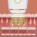 IPL Hair Removal Device - Portable & Compact for Face Legs Armpits & Bikini Area - Best eCommerce Solution - Buy Online on SooperMarket.com