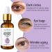 Anti-Aging Retinol Rejuvenation Eye Serum - Under Eye Cream For Dark Circles And Puffy Eyes With Collagen & Retinol Under Eye Serum Eye Serum For Lines And Wrinkles Eye Cream Anti Aging - Buy Online on SooperMarket.com