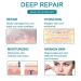 Medical Grade Silicone Scar Tape Roll (1.6 x 60) for Scar Removal - Professional Silicone Strips for Surgery, C-Section, Acne, Burn and Keloid - Safe & Reusable - 1.5M - Buy Online on SooperMarket.com