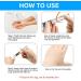 Extra Strength Skin Tag Remover | Wart Removal | Tag Dries and Falls Away | Natural Ingredients | All Skin Types - Buy Online on SooperMarket.com